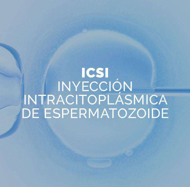 tratamiento icsi